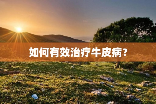 如何有效治疗牛皮病？