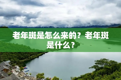 老年斑是怎么来的？老年斑是什么？