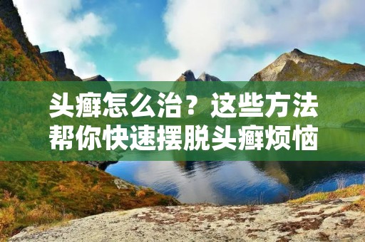 头癣怎么治?这些方法帮你快速摆脱头癣烦恼! 头癣怎么治?这些方法帮你快速摆脱头癣烦恼!