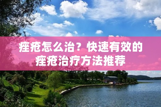 痤疮怎么治?快速有效的痤疮治疗方法推荐 痤疮怎么治?快速有效的痤疮治疗方法推荐