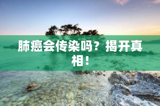 肺癌会传染吗?揭开真相! 肺癌会传染吗?揭开真相!