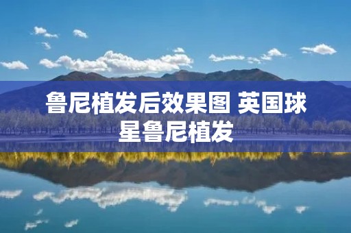 鲁尼植发后效果图 英国球星鲁尼植发