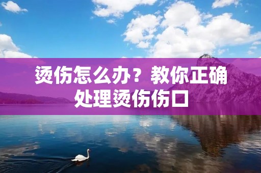 烫伤怎么办?教你正确处理烫伤伤口 烫伤怎么办?教你正确处理烫伤伤口