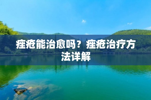 痤疮能治愈吗?痤疮治疗方法详解 痤疮能治愈吗?痤疮治疗方法详解