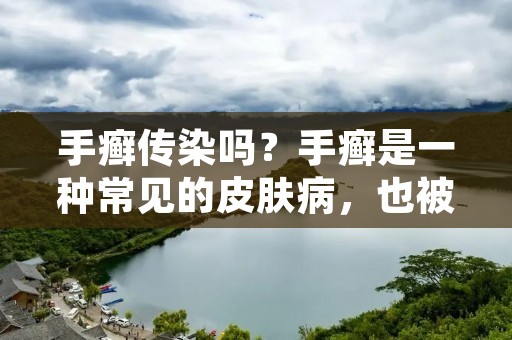 手癣传染吗?手癣是一种常见的皮肤病,也被称为皮肤真菌病。它是由真菌感染引起的,通常会在双手和手指的皮肤上产生瘙痒、红肿和脱皮的症状。许多人都会担心手癣是否会传染给他人。本文将详细介绍手癣传染的原因和预防方法。 手癣传染吗?手癣是一种常见的皮肤病,也被称为皮肤真菌病。它是由真菌感染引起的,通常会在双手和手指的皮肤上产生瘙痒、红肿和脱皮的症状。许多人都会担心手癣是否会传染给他人。本文将详细介绍手癣传染的原因和预防方法。