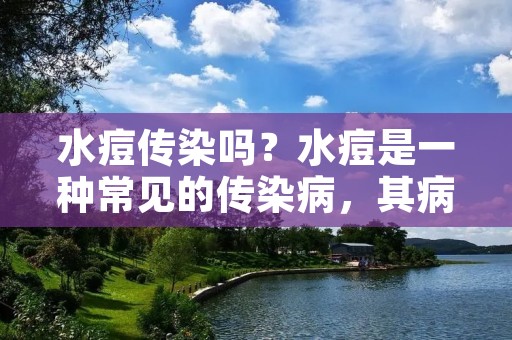 水痘传染吗？水痘是一种常见的传染病，其病原体为水痘-带状疱疹病毒，主要通过飞沫传播。水痘的传染性较强，易于在人群中传播，尤其是在儿童和青少年之间。