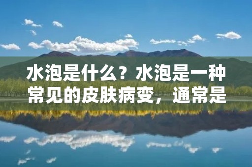 水泡是什么?水泡是一种常见的皮肤病变,通常是由于皮肤受到热、摩擦或其他**而引起的。水泡通常表现为皮肤上的小囊泡,内部充满了清澈的液体。水泡通常不需要特殊治疗,因为它们通常会自行消退。然而,一些情况下,水泡可能需要医疗干预。 水泡是什么?水泡是一种常见的皮肤病变,通常是由于皮肤受到热、摩擦或其他**而引起的。水泡通常表现为皮肤上的小囊泡,内部充满了清澈的液体。水泡通常不需要特殊治疗,因为它们通常会自行消退。然而,一些情况下,水泡可能需要医疗干预。
