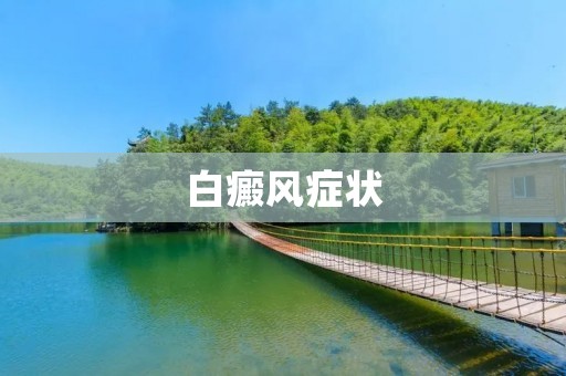 白癜风症状:了解白癜风的症状及治疗方法 白癜风症状:了解白癜风的症状及治疗方法