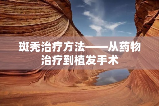 斑秃治疗方法——从药物治疗到植发手术 斑秃治疗方法——从药物治疗到植发手术