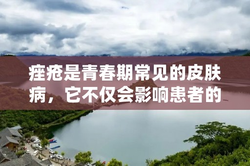 痤疮是青春期常见的皮肤病,它不仅会影响患者的外观,还会对其心理产生负面影响。治疗痤疮的方法有很多种,但不同的治疗方法对不同的人可能会有不同的效果。因此,在选择治疗方法时,我们需要根据自己的情况选择最合适的方法。 痤疮是青春期常见的皮肤病,它不仅会影响患者的外观,还会对其心理产生负面影响。治疗痤疮的方法有很多种,但不同的治疗方法对不同的人可能会有不同的效果。因此,在选择治疗方法时,我们需要根据自己的情况选择最合适的方法。
