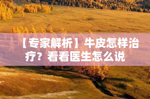 【专家解析】牛皮怎样治疗?看看医生怎么说 【专家解析】牛皮怎样治疗?看看医生怎么说