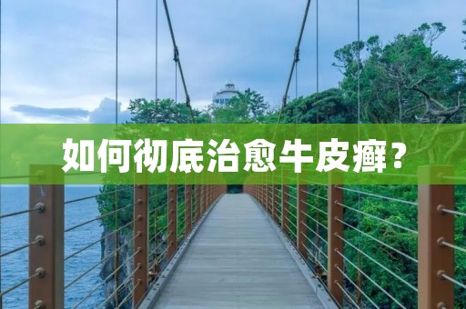 如何彻底治愈牛皮癣? 如何彻底治愈牛皮癣?