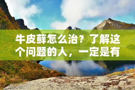 牛皮藓怎么治?了解这个问题的人,一定是有牛皮藓的烦恼。牛皮藓是一种常见的头皮病,它会给患者带来不少的烦恼和困扰。那么,牛皮藓如何治疗?如何预防?下面我们就来详细了解一下。 牛皮藓怎么治?了解这个问题的人,一定是有牛皮藓的烦恼。牛皮藓是一种常见的头皮病,它会给患者带来不少的烦恼和困扰。那么,牛皮藓如何治疗?如何预防?下面我们就来详细了解一下。