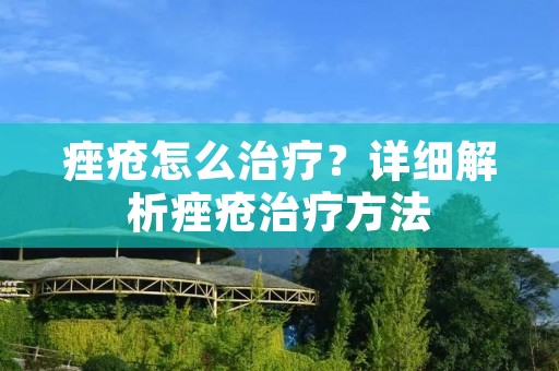 痤疮怎么治疗?详细解析痤疮治疗方法 痤疮怎么治疗?详细解析痤疮治疗方法