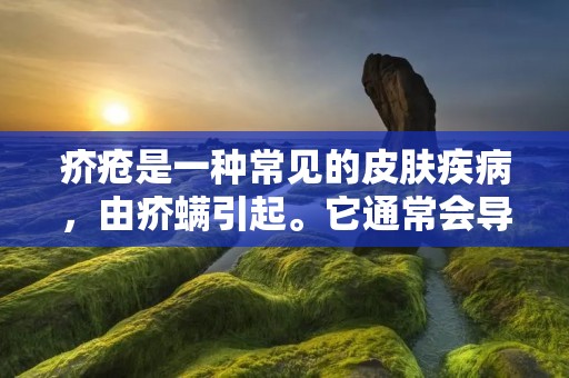 疥疮是一种常见的皮肤疾病,由疥螨引起。它通常会导致皮肤瘙痒、红肿、疱疹和皮肤脱屑等症状。如果不加治疗,疥疮会持续数周或数月,严重的话会对患者的生活造成很大的影响。本文将详细介绍疥疮的治疗方法。 疥疮是一种常见的皮肤疾病,由疥螨引起。它通常会导致皮肤瘙痒、红肿、疱疹和皮肤脱屑等症状。如果不加治疗,疥疮会持续数周或数月,严重的话会对患者的生活造成很大的影响。本文将详细介绍疥疮的治疗方法。