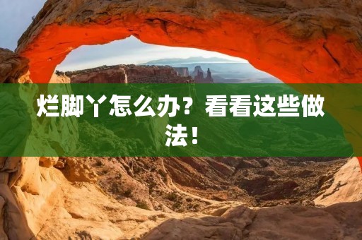 烂脚丫怎么办?看看这些做法! 烂脚丫怎么办?看看这些做法!