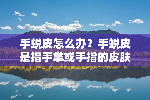 手蜕皮怎么办？手蜕皮是指手掌或手指的皮肤出现脱落现象，这可能是由于干燥、过度洗手、过度摩擦、过度暴露于阳光下或其他原因引起的。手蜕皮不仅会引起不适，而且还会影响外观，所以我们需要采取一些措施来缓解和预防手蜕皮。