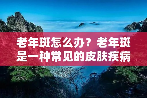 老年斑怎么办？老年斑是一种常见的皮肤疾病，主要表现为皮肤上出现色素沉着斑点，多发于面部、颈部、手背等暴露部位。老年斑虽然不会对健康产生太大的影响，但其影响美观，给人带来不少困扰。那么，老年斑怎么办？下面我们来详细了解一下。
