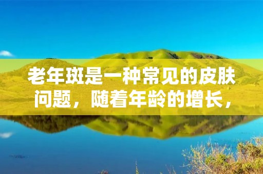 老年斑是一种常见的皮肤问题,随着年龄的增长,它会越来越明显。老年斑主要出现在面部、颈部、背部等暴露在阳光下的部位,给人带来不美观的感觉。那么,怎么去老年斑呢? 老年斑是一种常见的皮肤问题,随着年龄的增长,它会越来越明显。老年斑主要出现在面部、颈部、背部等暴露在阳光下的部位,给人带来不美观的感觉。那么,怎么去老年斑呢?