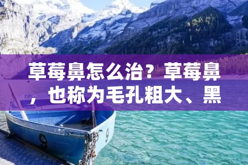 草莓鼻怎么治？草莓鼻，也称为毛孔粗大、黑头粉刺严重的鼻子，是很多人都会遭遇的问题。虽然草莓鼻不是严重的皮肤疾病，但它可以让人感到不自信和不舒服。如果你正在寻找草莓鼻治疗的方法，那么接下来的内容将为你提供一些有用的建议。