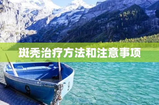 斑秃治疗方法和注意事项 斑秃治疗方法和注意事项