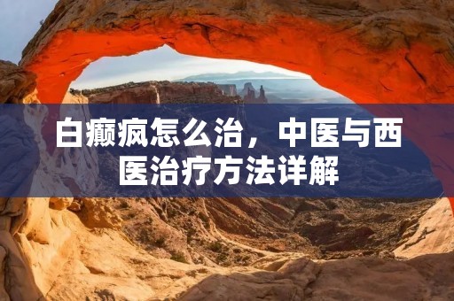 白癫疯怎么治,中医与西医治疗方法详解 白癫疯怎么治,中医与西医治疗方法详解