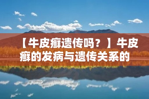 【牛皮癣遗传吗？】牛皮癣的发病与遗传关系的探讨
