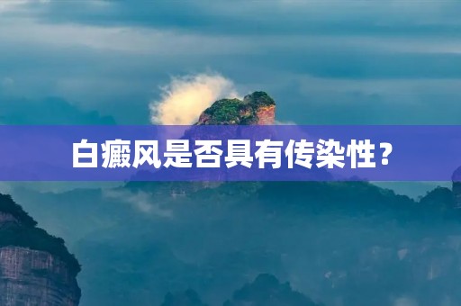 白癜风是否具有传染性?