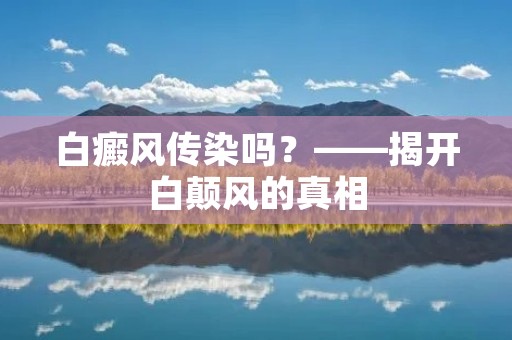白癜风传染吗?——揭开白颠风的真相