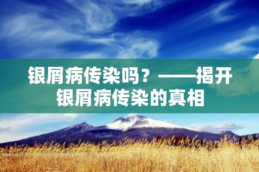 银屑病传染吗?——揭开银屑病传染的真相