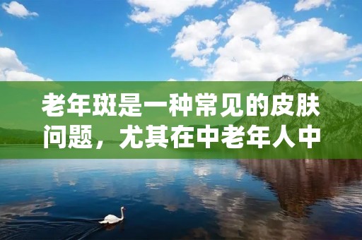 老年斑是一种常见的皮肤问题,尤其在中老年人中较为普遍。它通常表现为皮肤上出现淡褐色或黑色的斑点,多分布于面部、手背、颈部和前臂等暴露部位。老年斑虽然不会对健康造成直接威胁,但对于患者的外貌形象和心理状态有一定影响。