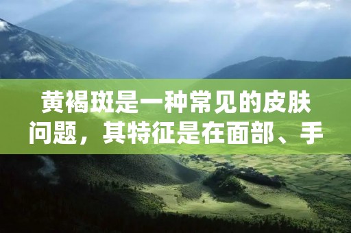 黄褐斑是一种常见的皮肤问题,其特征是在面部、手背、前臂等暴露部位出现的棕色斑块。它主要由于皮肤内色素沉着过多而引起,多发生在中老年人群中。黄褐斑虽然不会对身体健康造成直接威胁,但会给患者的外貌带来困扰,降低患者的自信心。因此,了解黄褐斑的成因和治疗方法对于患者来说非常重要。