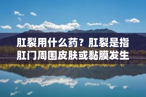 肛裂用什么药?肛裂是指肛门周围皮肤或黏膜发生裂口的一种疾病,常常伴随着剧烈的疼痛和出血。治疗肛裂的方法有很多,其中药物治疗是常见的一种方法。本文将详细介绍肛裂的药物治疗方法,帮助读者更好地了解肛裂的治疗过程。