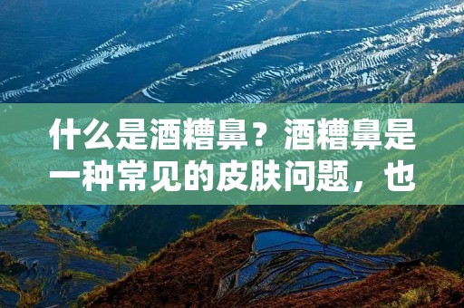 什么是酒糟鼻?酒糟鼻是一种常见的皮肤问题,也被称为酒渣鼻或酒糟症。它通常表现为鼻部皮肤发红、出现细小的血管扩张、粗糙、干燥、有时伴有疼痛和瘙痒感。酒糟鼻主要发生在成年人中,尤其是中年人。 什么是酒糟鼻?酒糟鼻是一种常见的皮肤问题,也被称为酒渣鼻或酒糟症。它通常表现为鼻部皮肤发红、出现细小的血管扩张、粗糙、干燥、有时伴有疼痛和瘙痒感。酒糟鼻主要发生在成年人中,尤其是中年人。