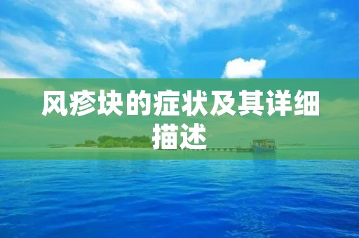 风疹块的症状及其详细描述
