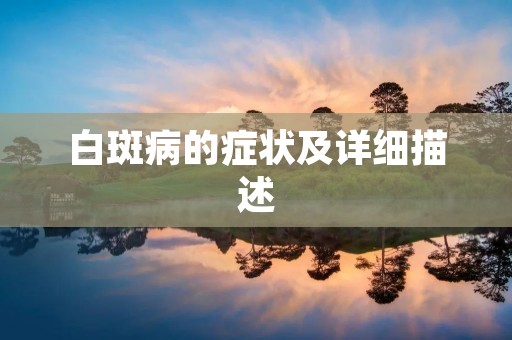 白斑病的症状及详细描述