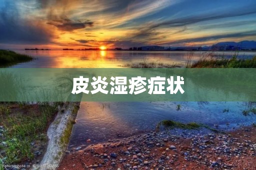 皮炎湿疹症状：详细描述及治疗方法