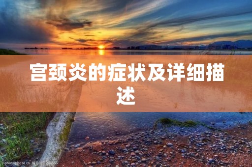 宫颈炎的症状及详细描述