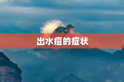 出水痘的症状:详细描述