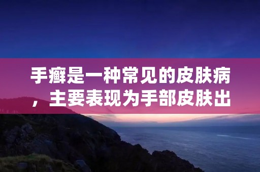 手癣是一种常见的皮肤病,主要表现为手部皮肤出现红斑、脱屑、瘙痒等症状。如果不及时治疗,手癣可能会影响日常生活和工作。那么,如何治疗手癣呢?