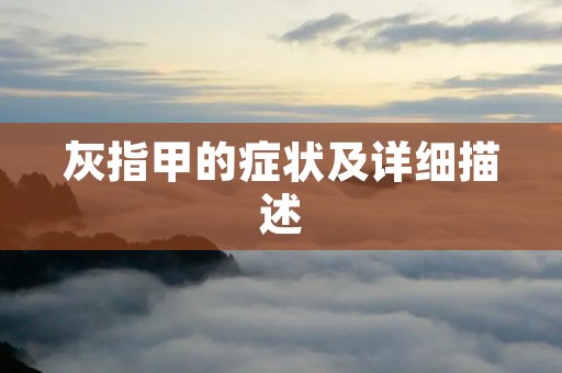 灰指甲的症状及详细描述