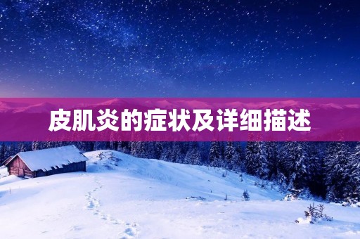 皮肌炎的症状及详细描述