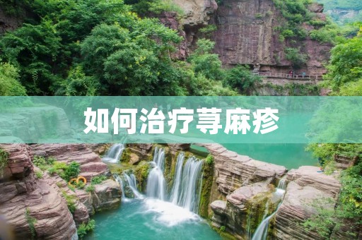 如何治疗荨麻疹