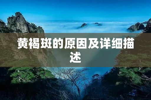 黄褐斑的原因及详细描述 黄褐斑的原因及详细描述