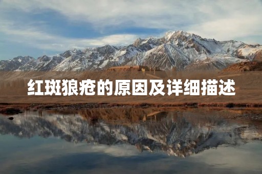 红斑狼疮的原因及详细描述