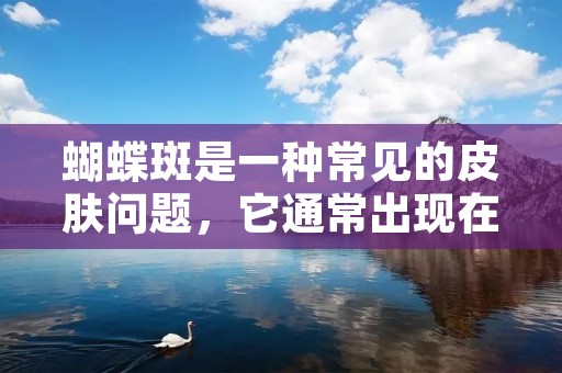 蝴蝶斑是一种常见的皮肤问题，它通常出现在面部，给人们的外貌带来困扰。许多人都希望能够找到有效的方法去除蝴蝶斑，恢复肌肤的健康和光泽。那么，怎么去除蝴蝶斑呢？