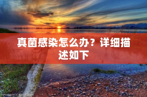 真菌感染怎么办?详细描述如下: