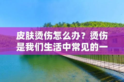 皮肤烫伤怎么办?烫伤是我们生活中常见的一种伤害,它会给我们的皮肤带来不同程度的损伤,给我们带来疼痛和不适。那么,在面对皮肤烫伤时,我们应该如何处理呢?下面,就让我们一起来了解一下。