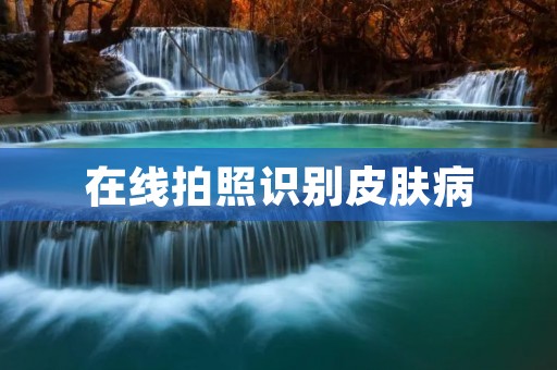 在线拍照识别皮肤病:让诊断更快捷更便利 在线拍照识别皮肤病:让诊断更快捷更便利