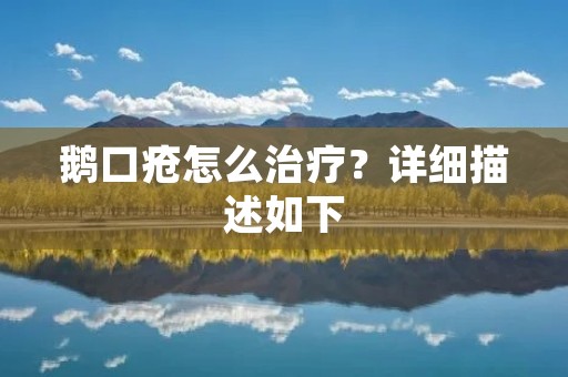 鹅口疮怎么治疗?详细描述如下: